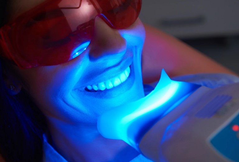 Teeth Whitening in Sevenoaks, Kent