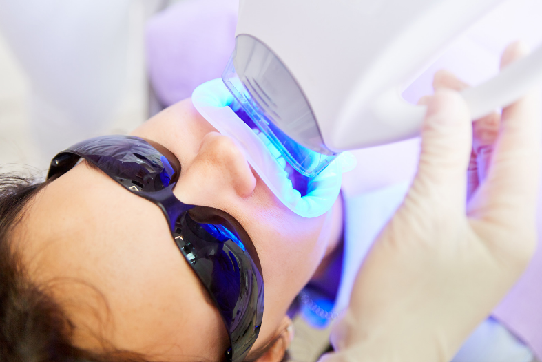 Teeth Whitening in Sevenoaks, Kent